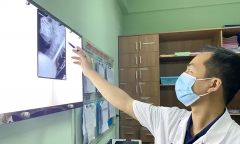 Rơi tự do từ tầng cao xuống, nam thanh niên 18 tuổi bị thanh sắt xuyên thấu từ cổ qua não