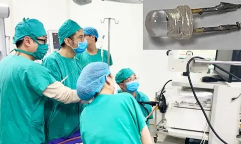 Bé 10 tháng tuổi nuốt phải... bóng đèn điện tử