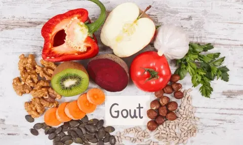 Một số lưu ý trong chế độ ăn cho người bệnh gout