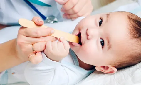 Trẻ sơ sinh bị nấm miệng phải làm sao?