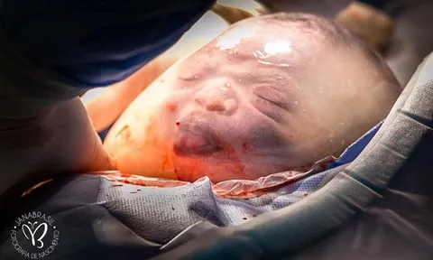 Gặp lại cậu bé từng "gây sốt" với bức ảnh chào đời trong bọc ối, lè lưỡi "trêu" bác sĩ