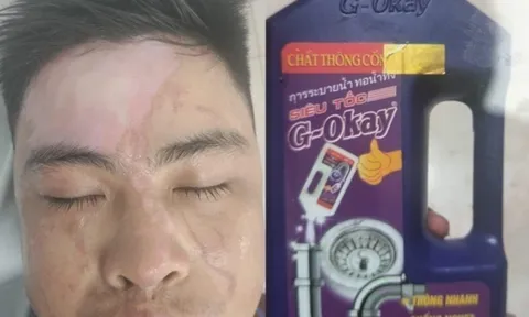 Người đàn ông bị bỏng nặng sau khi dùng nước thông cống siêu tốc