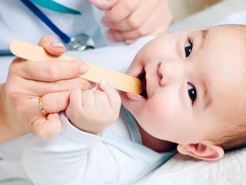 Trẻ sơ sinh bị nấm miệng phải làm sao?