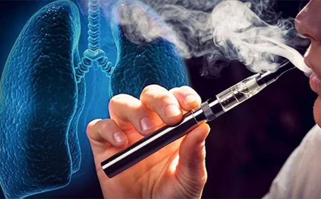 Ngộ độc thuốc lá điện tử: Hệ lụy khôn lường